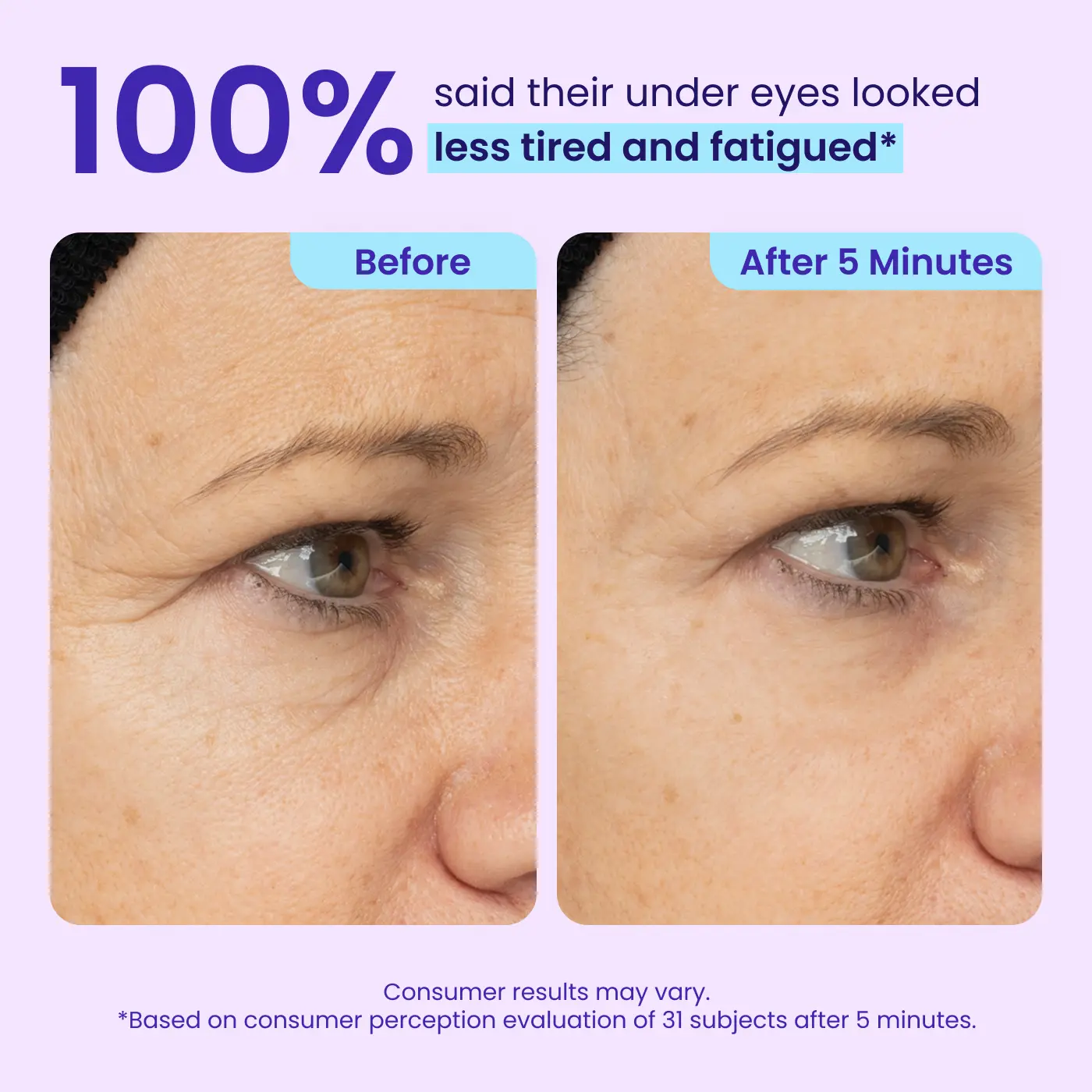Erase Eye Bags in Minutes — JUXEK Eye Cream Look Refreshed Instantly ⚡Flash Sale🔥