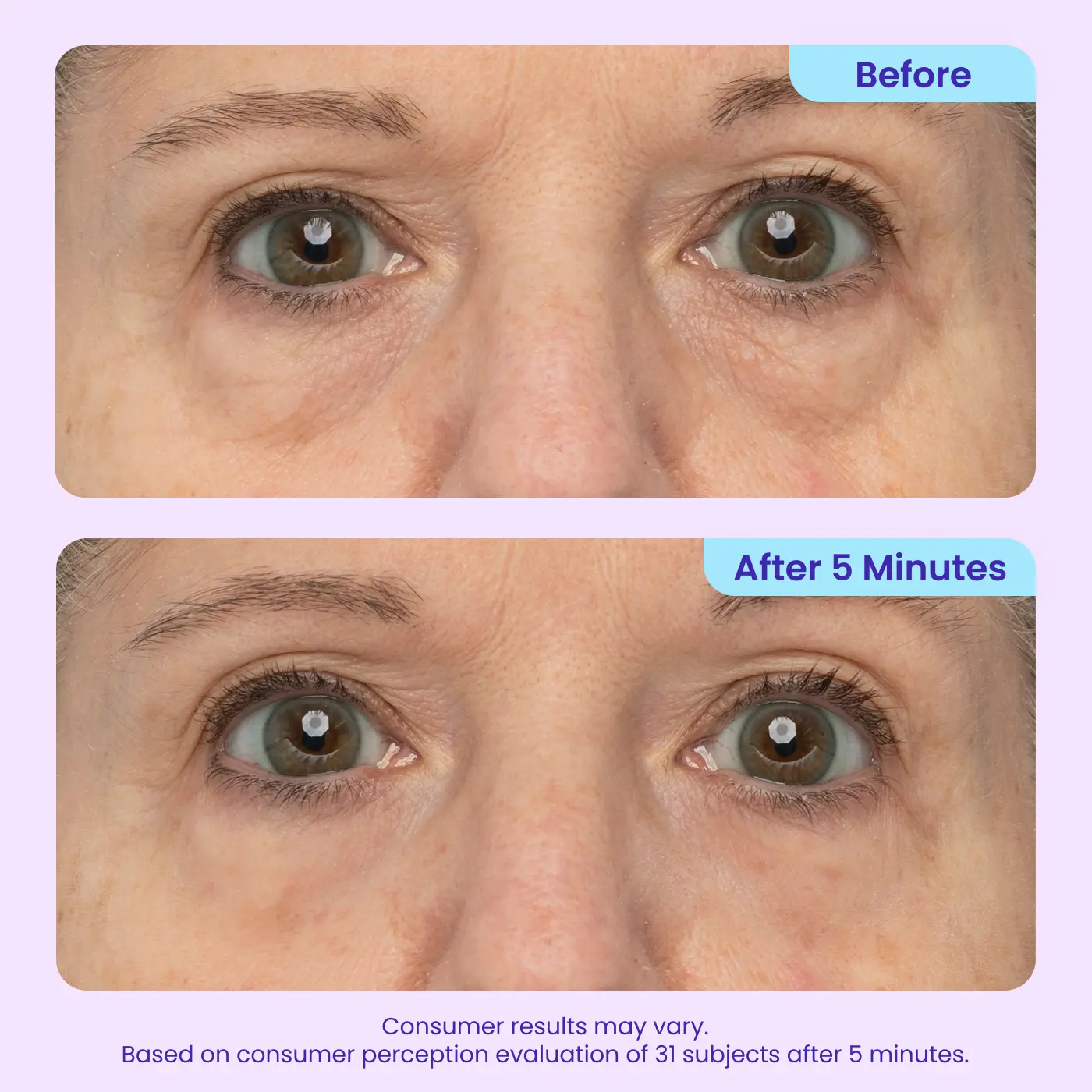 Erase Eye Bags in Minutes — JUXEK Eye Cream Look Refreshed Instantly ⚡Flash Sale🔥