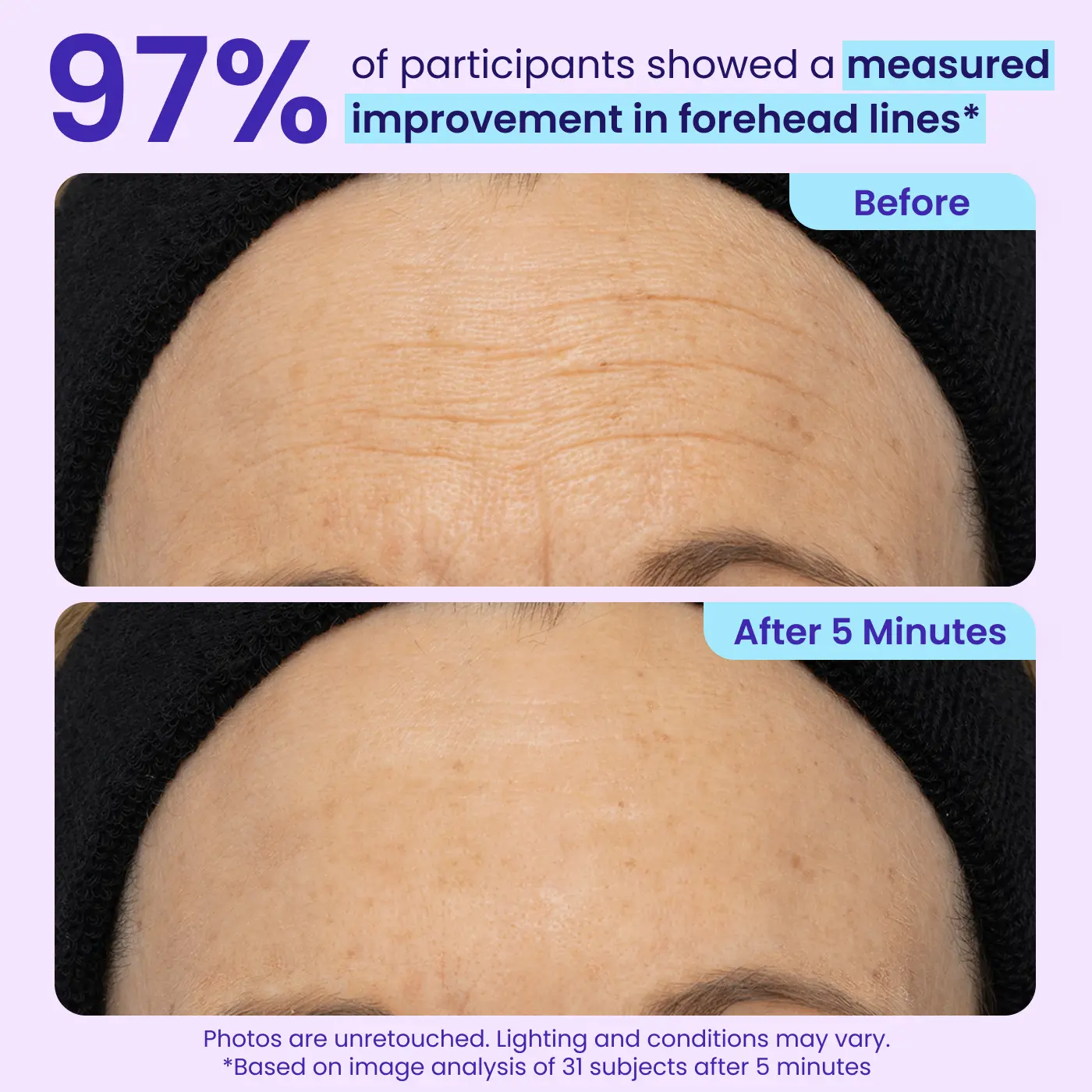 Erase Eye Bags in Minutes — JUXEK Eye Cream Look Refreshed Instantly ⚡Flash Sale🔥