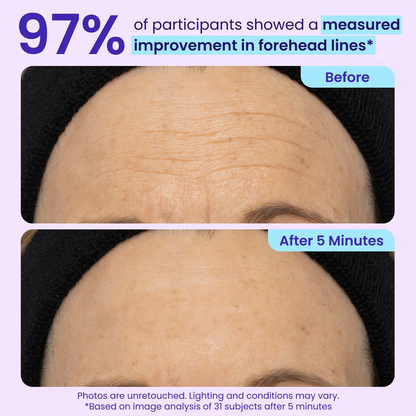 Erase Eye Bags in Minutes — JUXEK Eye Cream Look Refreshed Instantly ⚡Flash Sale🔥