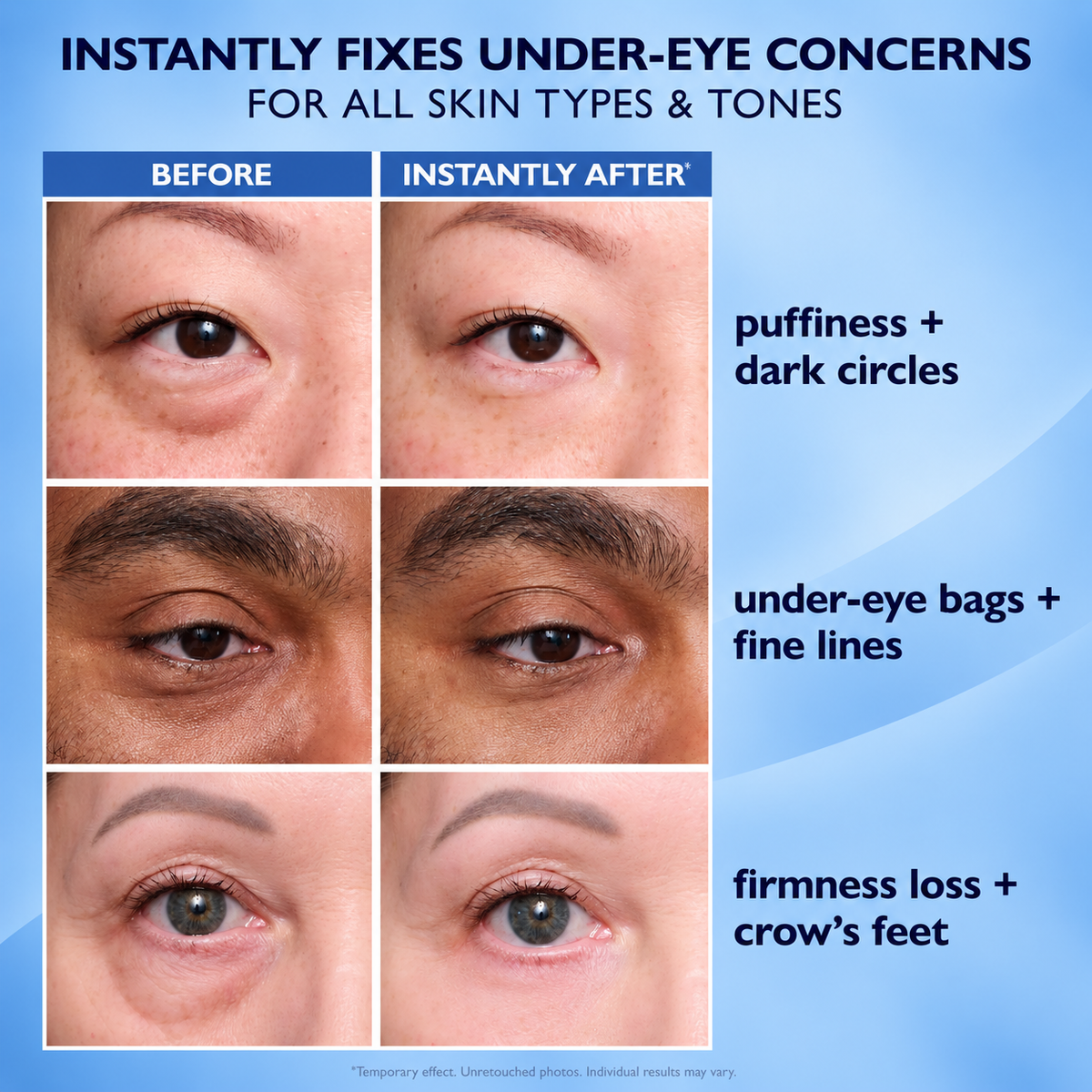 Alisanda™ Eye Tightener Easy