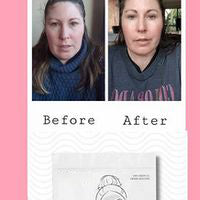 Face Plumping Duo