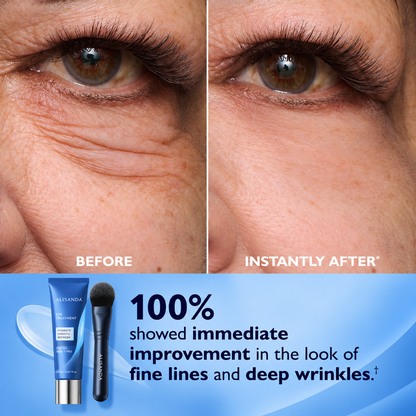 Alisanda™ Eye Tightener Easy