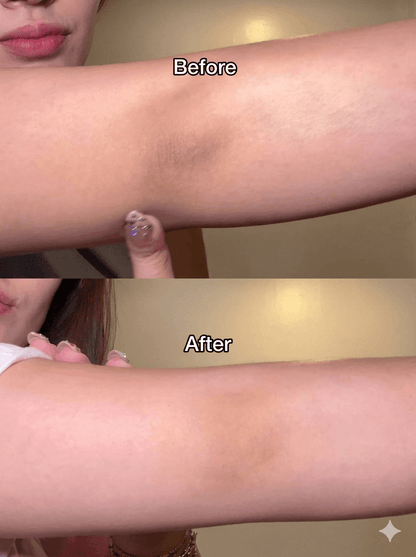 Kojic Acid and Turmeric Exfoliating Spray